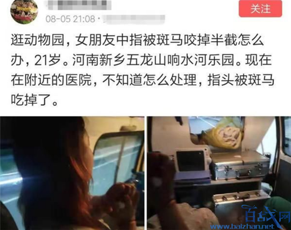 女子被斑马咬掉手指