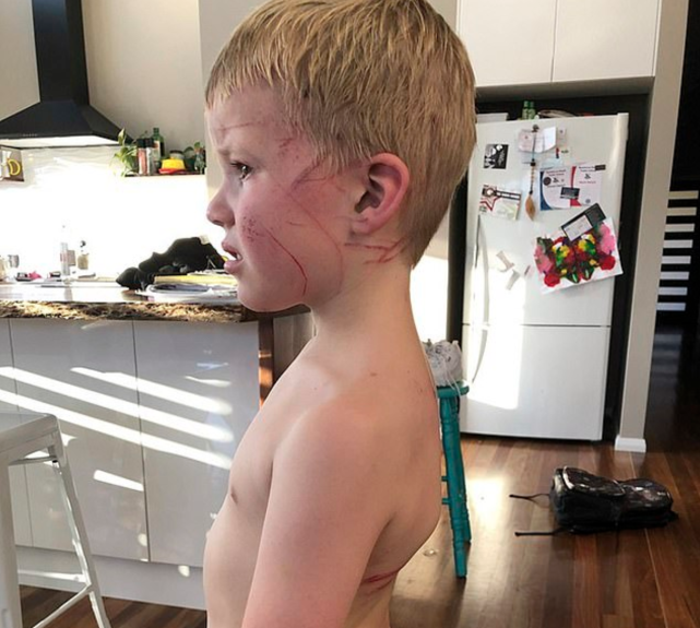 澳大利亚一父亲徒手击倒2米高袋鼠并将其踩死 因儿子被伤害激发了本能