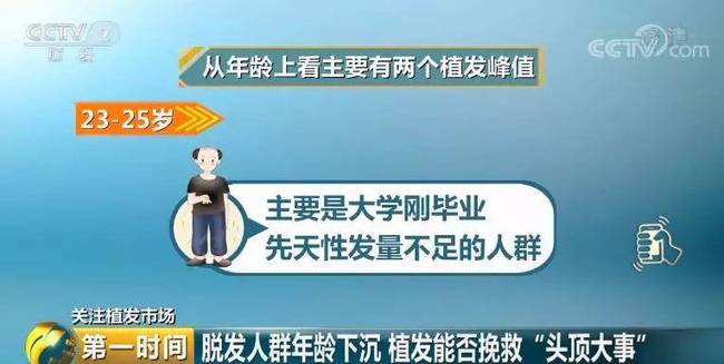 惊呆!全国脱发人群超2.5亿 平均6个人就有一人脱发