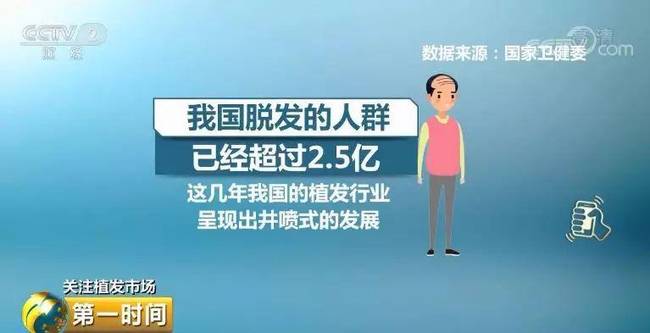 惊呆!全国脱发人群超2.5亿 平均6个人就有一人脱发