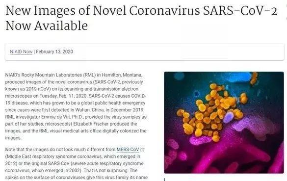 新冠病毒电镜图像公布 来看看新冠病毒的“高清彩照”
