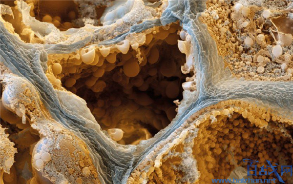 美科学家确认癌细胞生物学机制