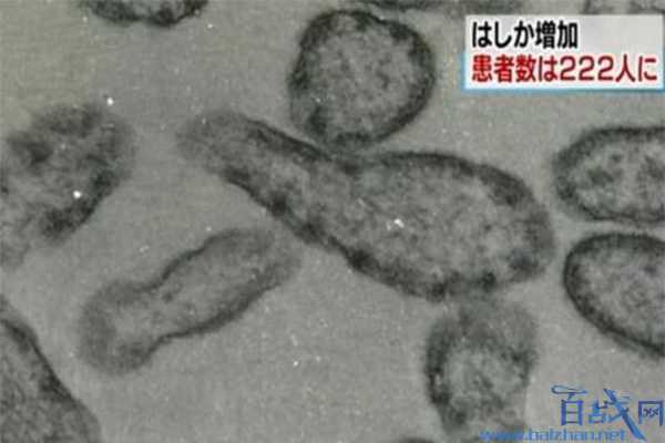 日本麻疹疫情蔓延